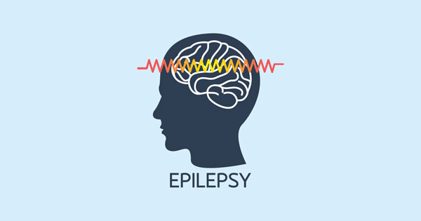 Epilepsy