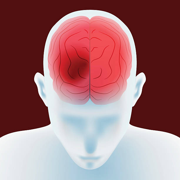 Brain Hemorrhage Treatment in Agra - Dr Vinay Agrawal