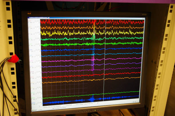 Video EEG Test in Agra - Dr Vinay Agrawal